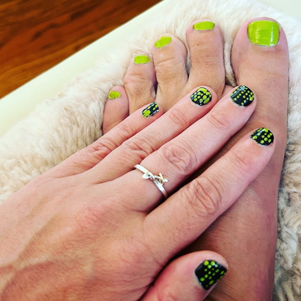 Neon toenail