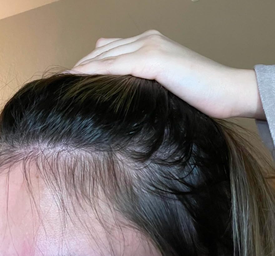 MONAT IR Clinical System – Complete Hair Care Restoration Kit with Thickening Shampoo, Conditioner & Thinning Defense Serum – Strengthens, Protects, & Revives Hair for Thicker, Fuller-Looking Results Customer Review MONAT IR Clinical System – Complete Hair Care Restoration Kit with Thickening Shampoo, Conditioner & Thinning Defense Serum – Strengthens, Protects, & Revives Hair for Thicker, Fuller-Looking Results - Customer Photo 1