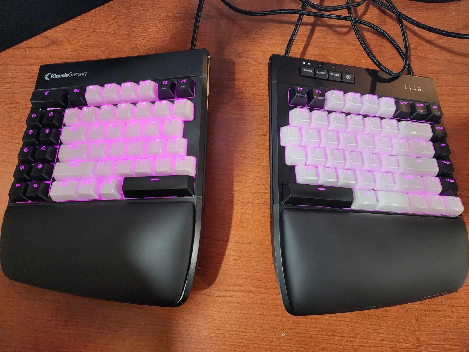 KINESIS Freestyle Edge RGB Plus Split Mechanical Keyboard | Hotswap Linear Switches | RGB | Ergonomic | Detachable Palm Support | Fully Programmable | Mac Keycaps Included | Lift Kit Included Customer Review KINESIS Freestyle Edge RGB Plus Split Mechanical Keyboard | Hotswap Linear Switches | RGB | Ergonomic | Detachable Palm Support | Fully Programmable | Mac Keycaps Included | Lift Kit Included - Customer Photo 1
